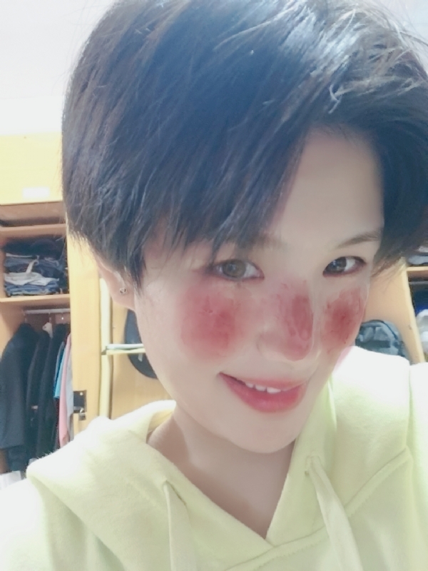⑤41的第一张照片--十堰残疾人相亲网